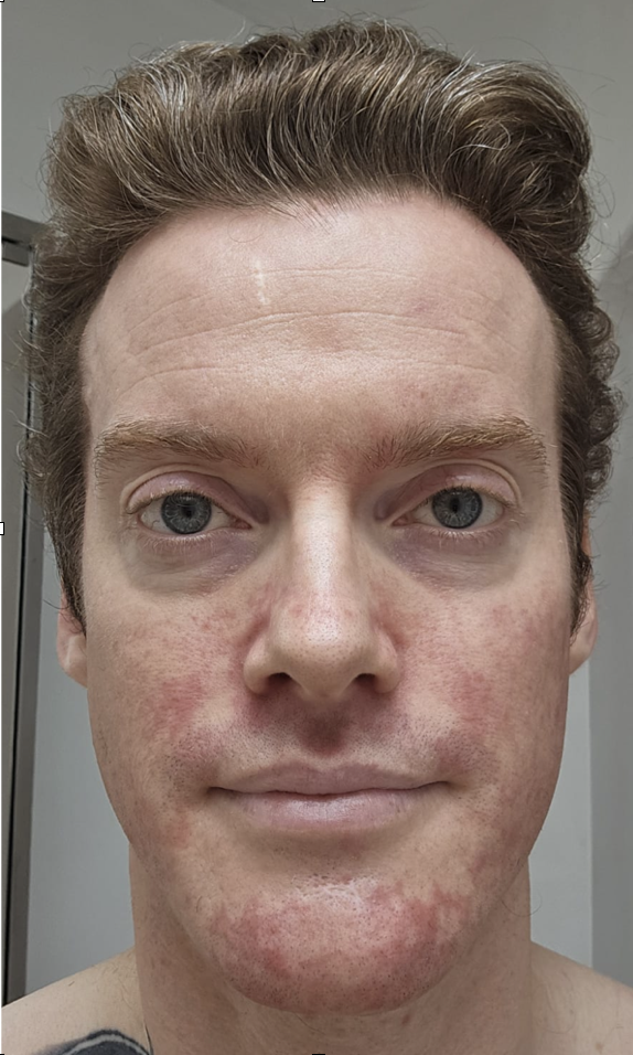 Aidan before working with Decoding Health