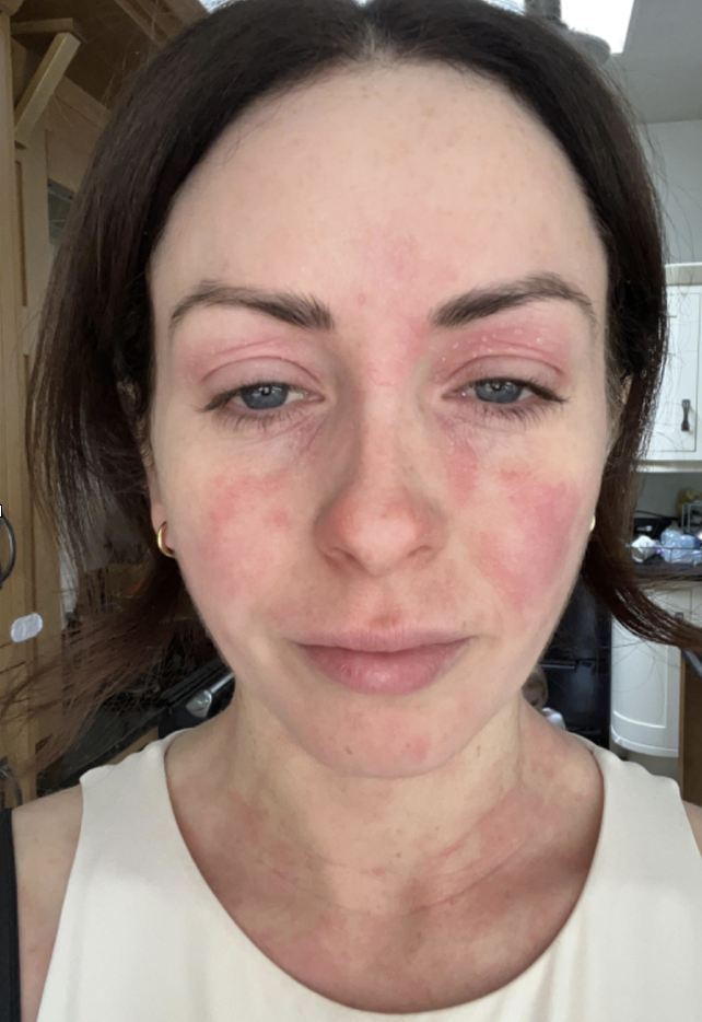 Kate before working with Decoding Health